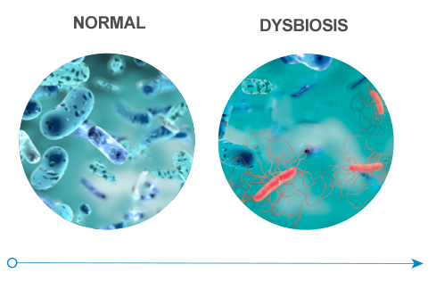 Healthy gut flora and Gut flora in a dysbiosis state
