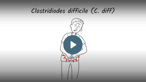 Video of Understanding a C. difficile infection